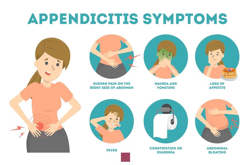 Comment diagnostiquer l'appendicite : Tests et symptômes à connaître