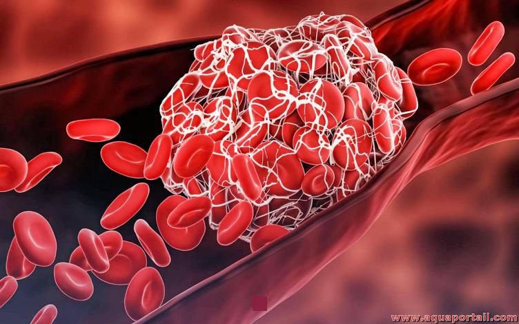 Comprendre les caillots de sang : de la formation normale aux risques potentiels